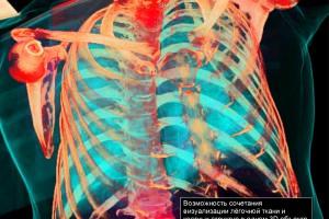 Фото клиники Центр компьютерной томографии в Люберцах