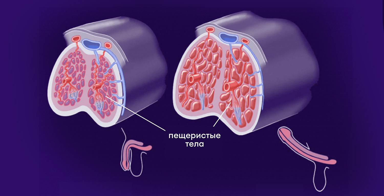 Кавернозография - проведение процедуры