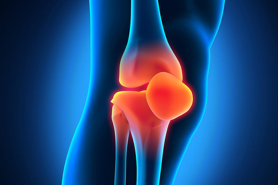 КТ коленного сустава - описание диагностики