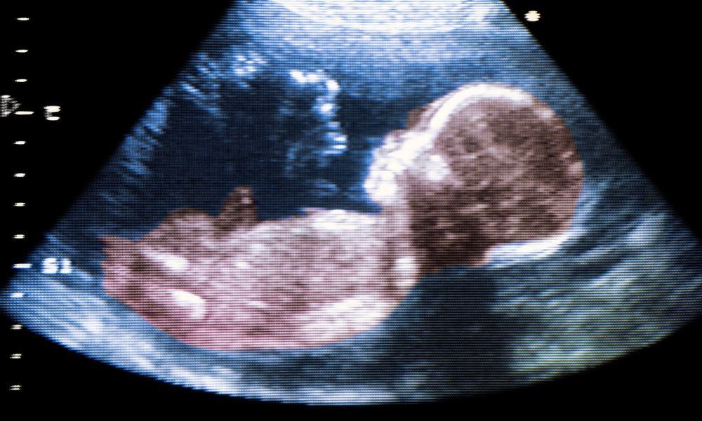 УЗИ при беременности 3 триместр - что показывают снимки