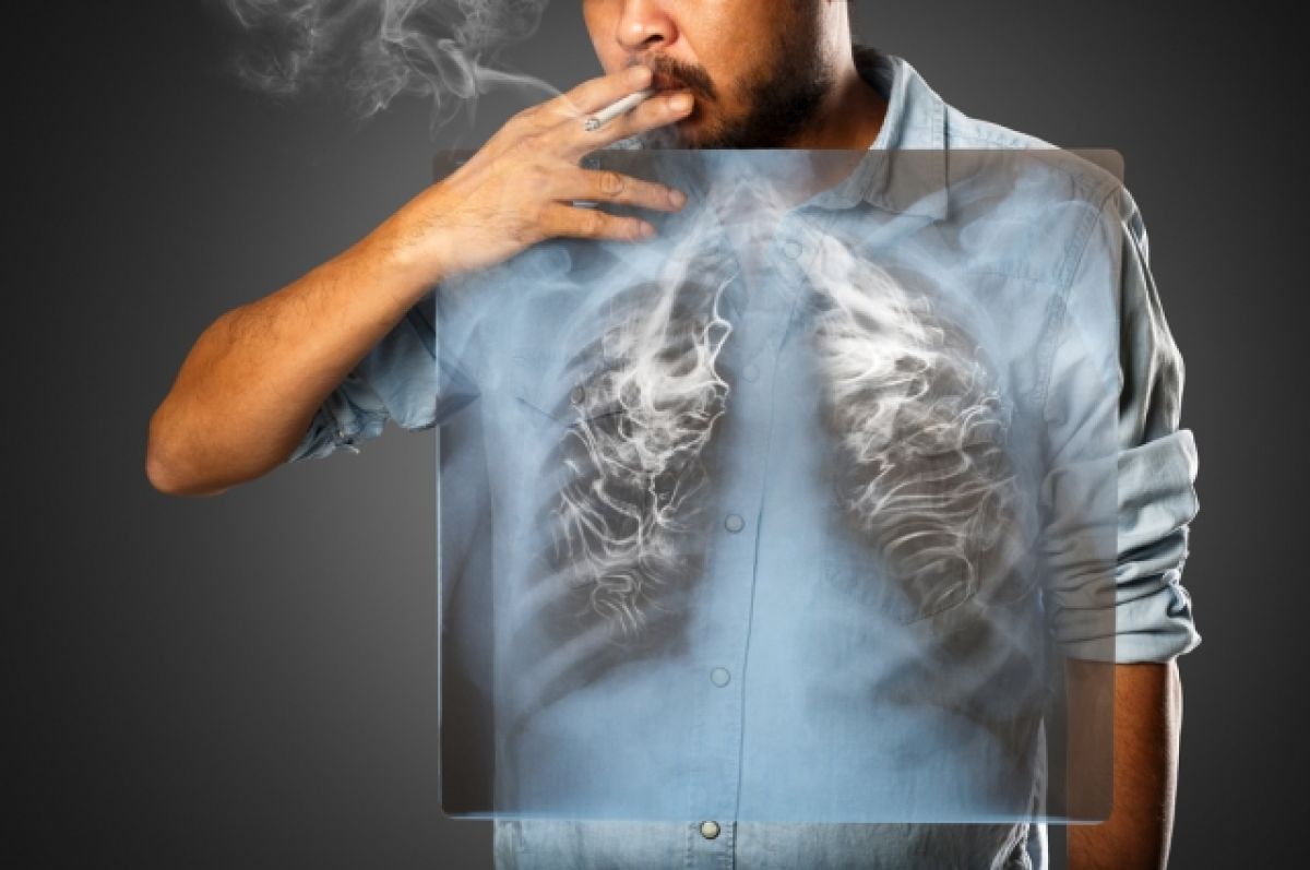 Курение - причина рака легких