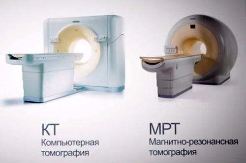 МРТ или КТ головного мозга - что лучше