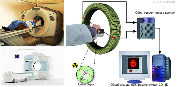 Принцип действия ПЭТ-КТ и устройство оборудования