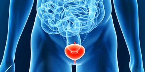 МРТ мочевого пузыря - диагностика