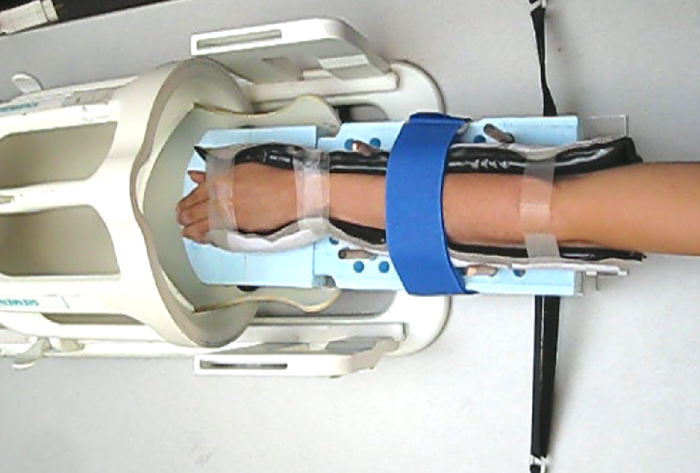 МРТ лучезапястного сустава - процедура