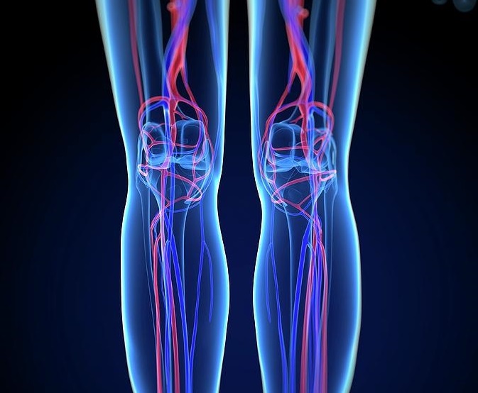 МРТ сосудов нижних конечностей - диагностика