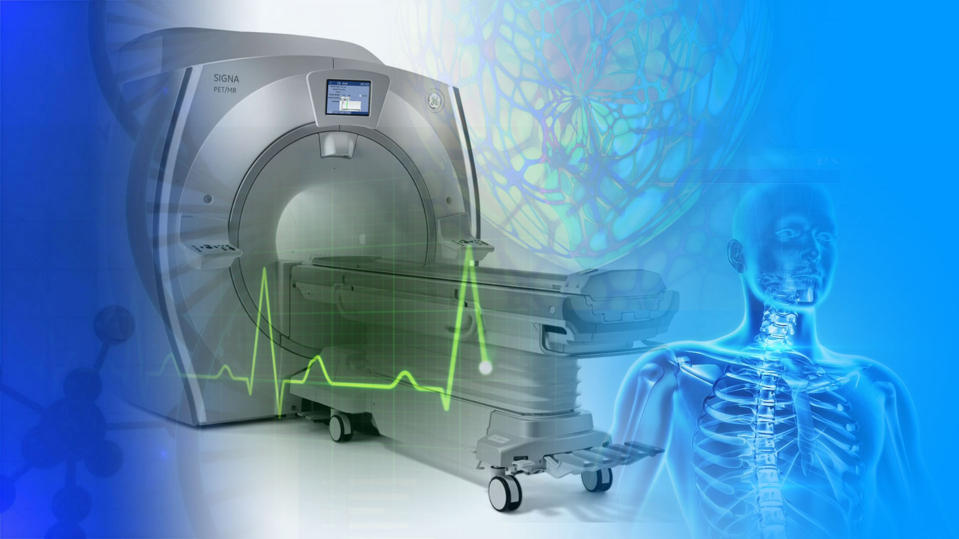 Новая технология сканирования в МРТ