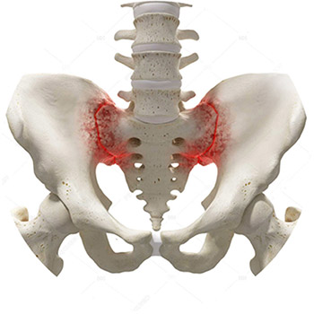 Рентген крестцово-подвздошных сочленений - диагностика