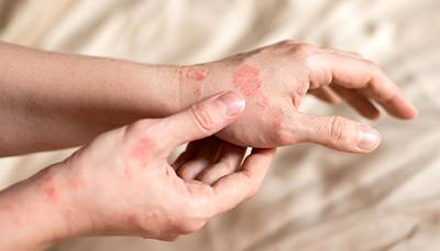 Аллергия на контраст - противопоказание к КТ височных костей