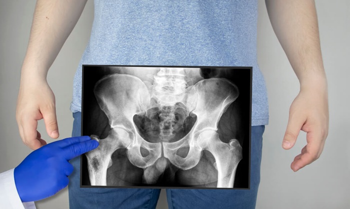 Рентген костей таза - показания