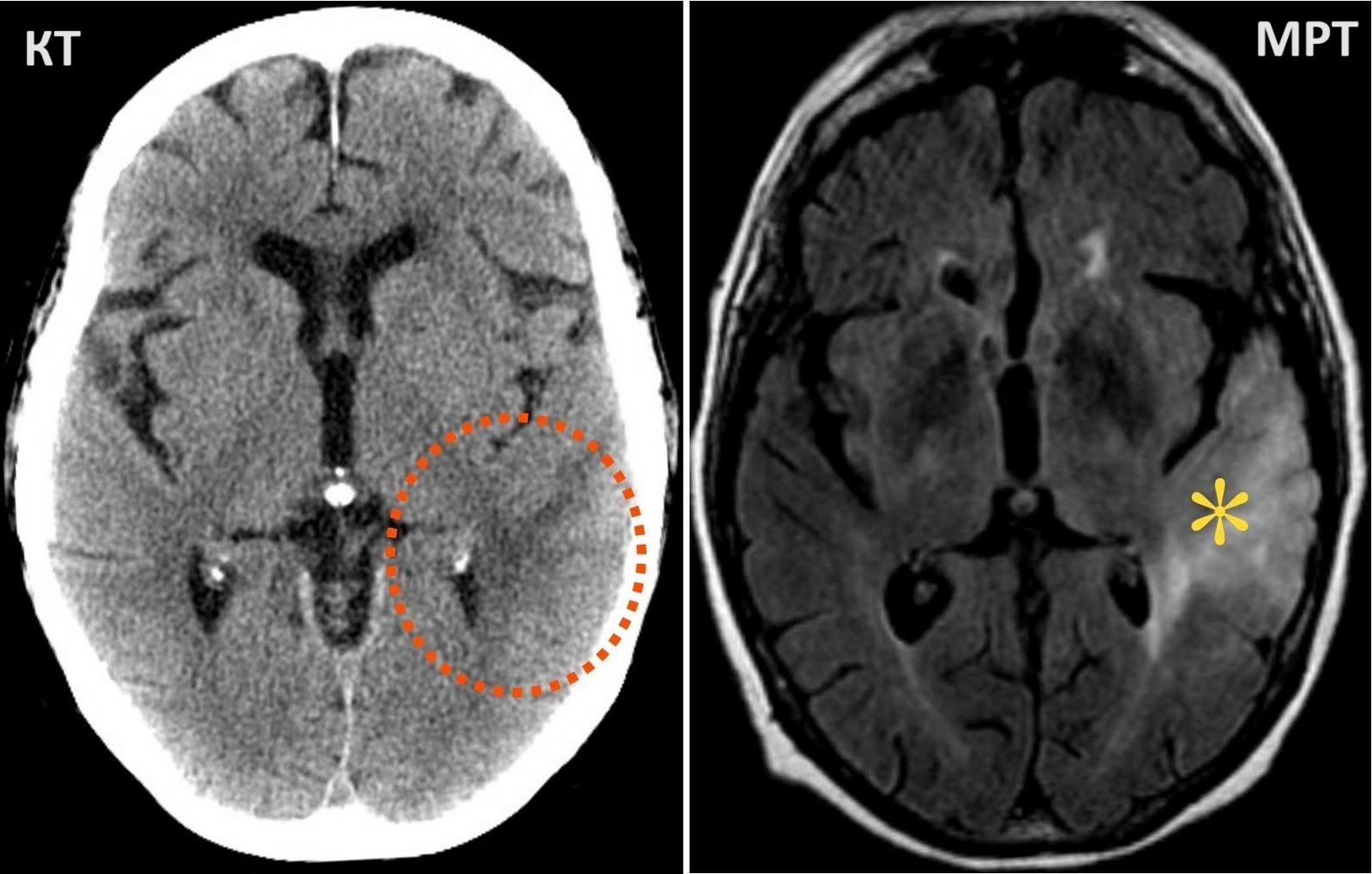 Отличия снимков КТ и МРТ головного мозга