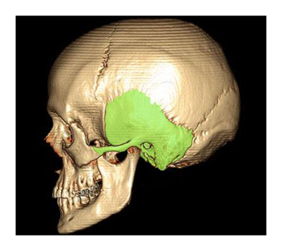 КТ височных костей - диагностика