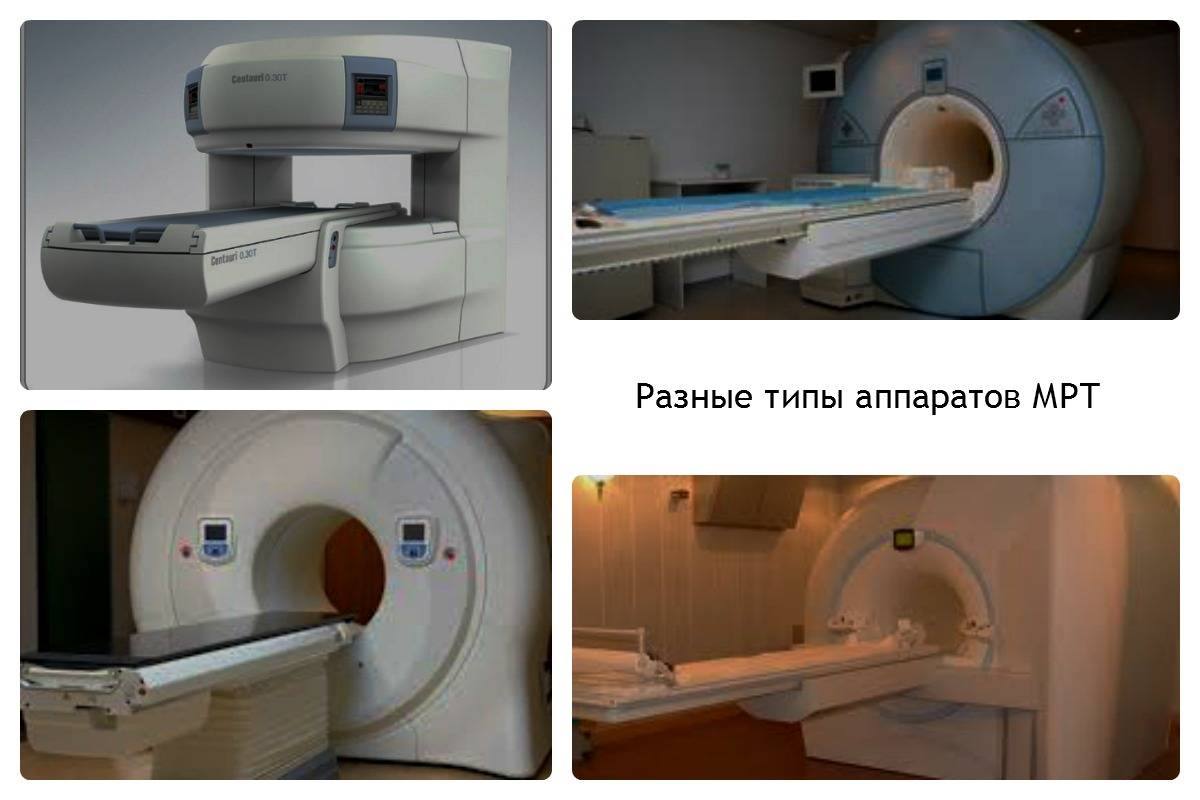 Виды МРТ аппаратов