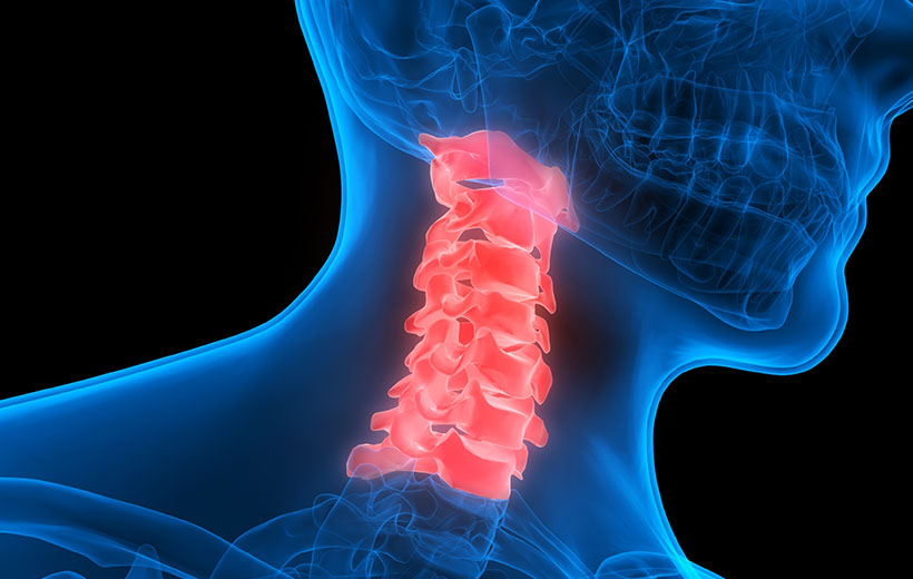 Рентген шейного отдела позвоночника - диагностика