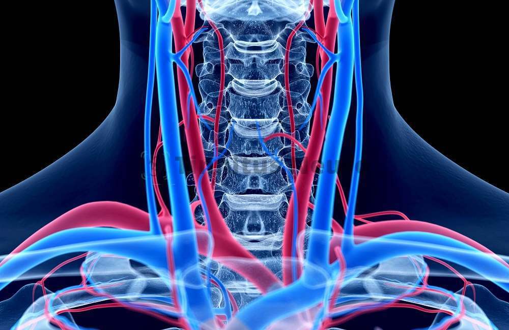 МРТ подключичных артерий - диагностика