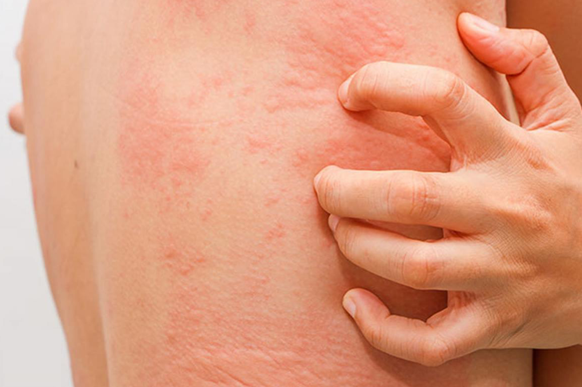 КТ надпочечников - возможные осложнения, аллергия