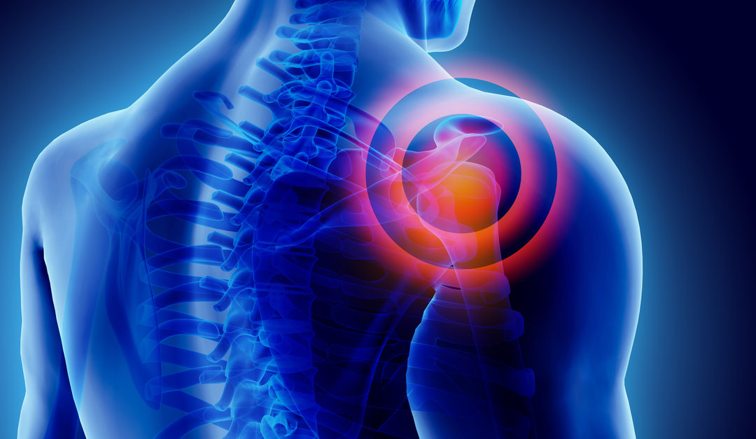 Рентген плечевого сустава - диагностика