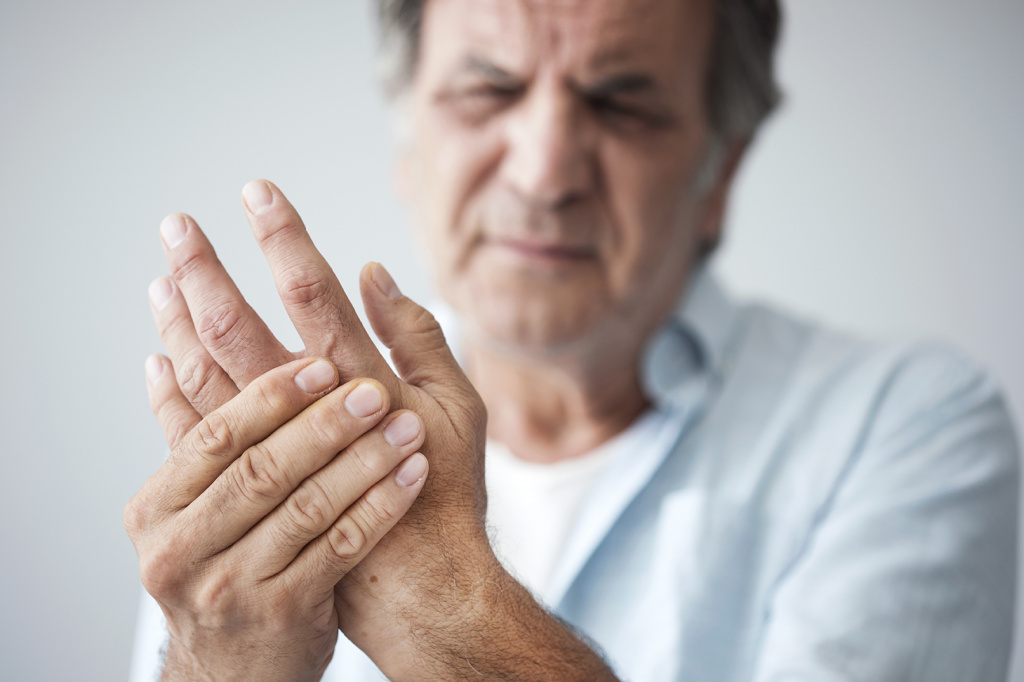 Ревматоидный артрит на руках