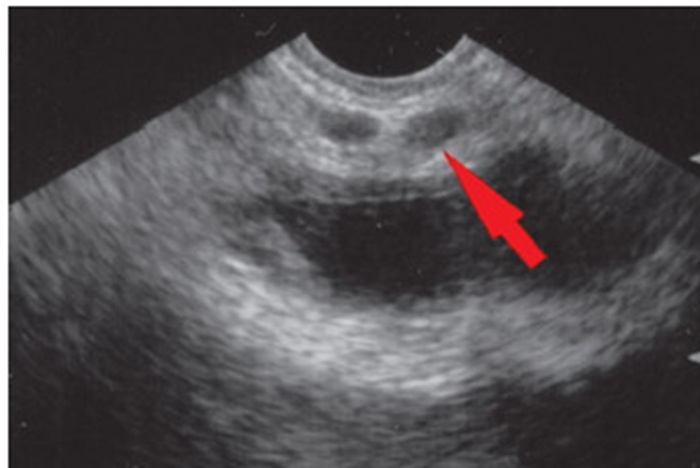 УЗИ мочеполовой системы мужчин - снимки