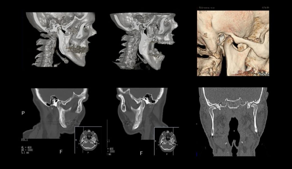 КТ ВНЧС - снимки в разных ракурсах.