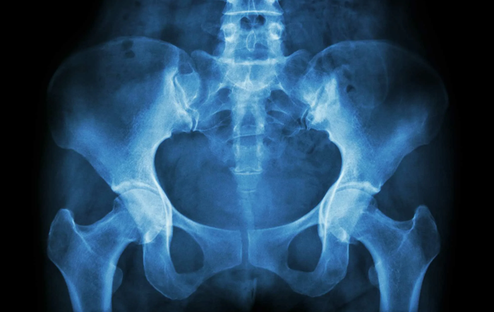 Рентген костей таза - снимки
