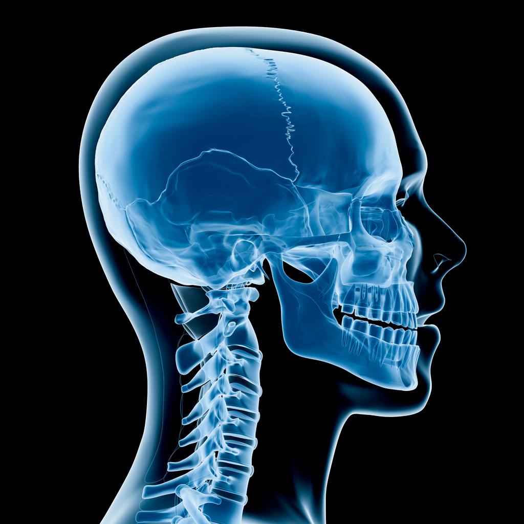 КТ костей лицевого черепа - диагностика