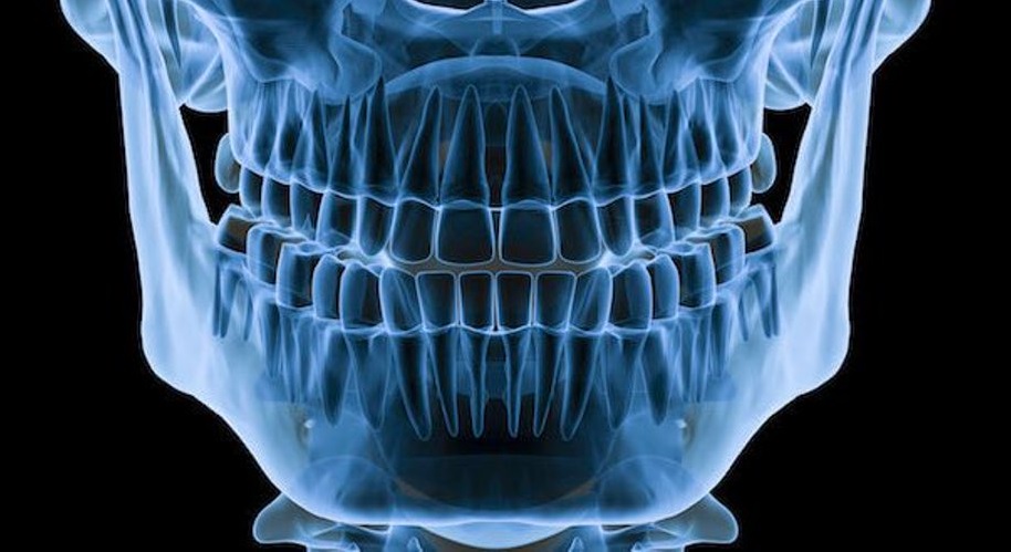 КТ челюсти - описание диагностики