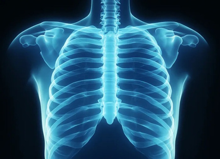 КТ ребер - описание процедуры