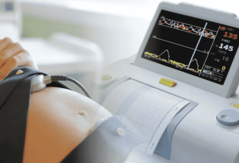 УЗИ кардиотокография плода (КТГ) - диагностика при беременности