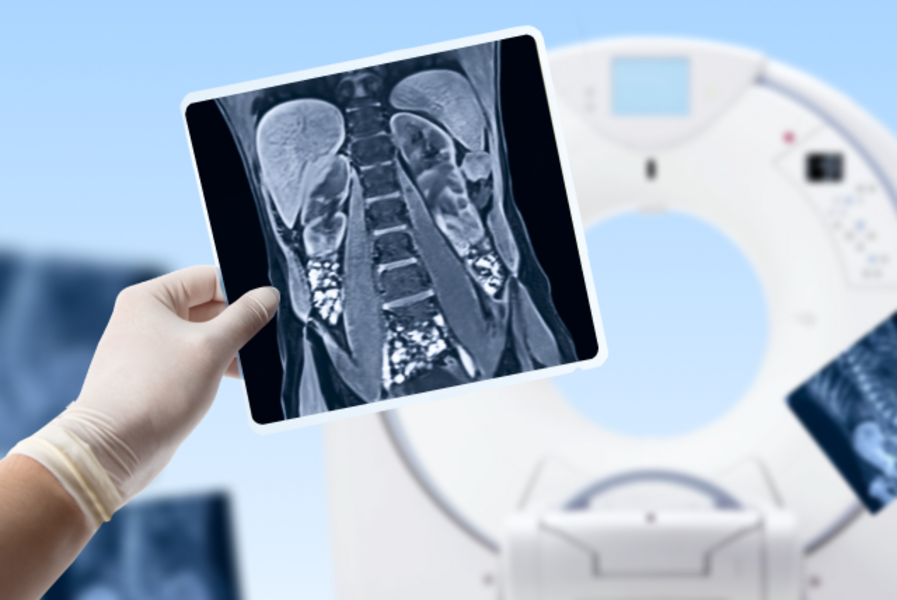 Расшифровка снимков МРТ забрюшинного пространства