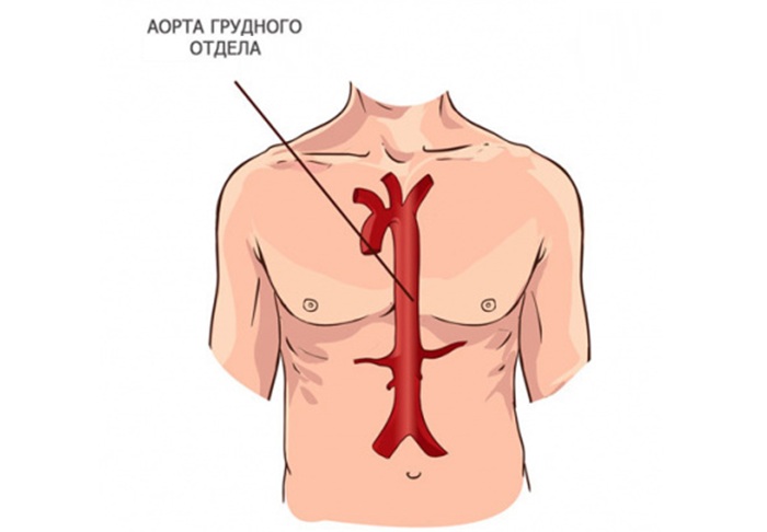 КТ грудной аорты - расположение и диагностика