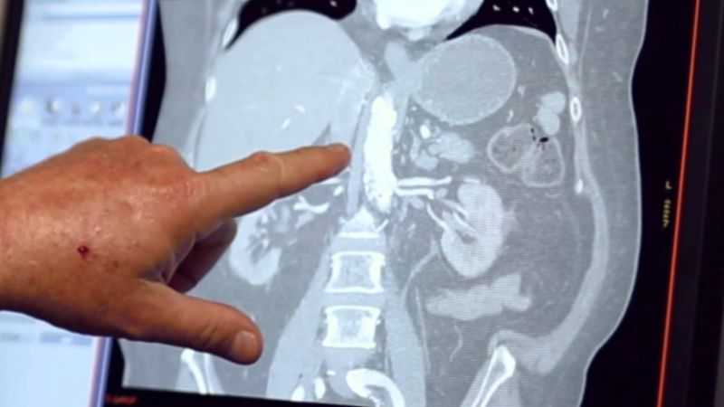 МРТ брюшной полости и забрюшинного пространства - что показывают снимки