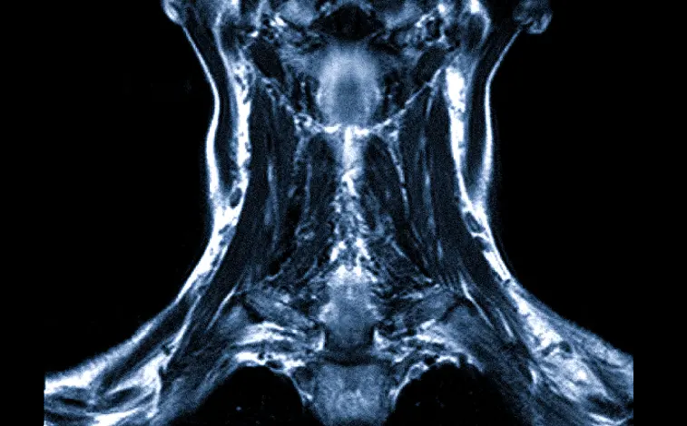 МРТ тканей шеи - снимки.