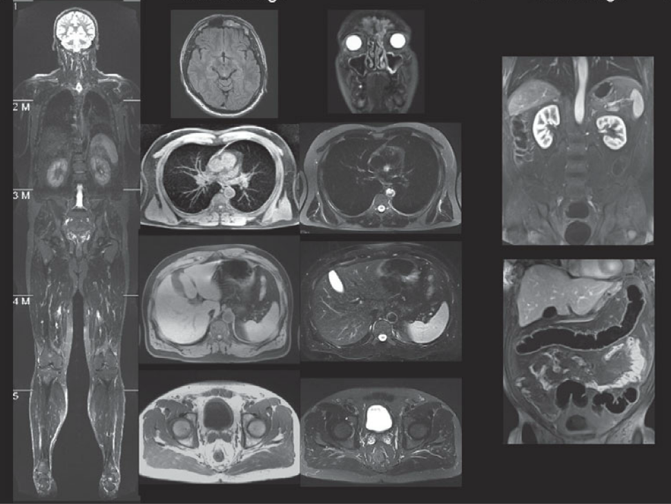 МРТ всего тела с контрастом - снимки