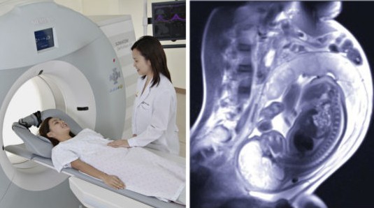 МРТ при беременности.