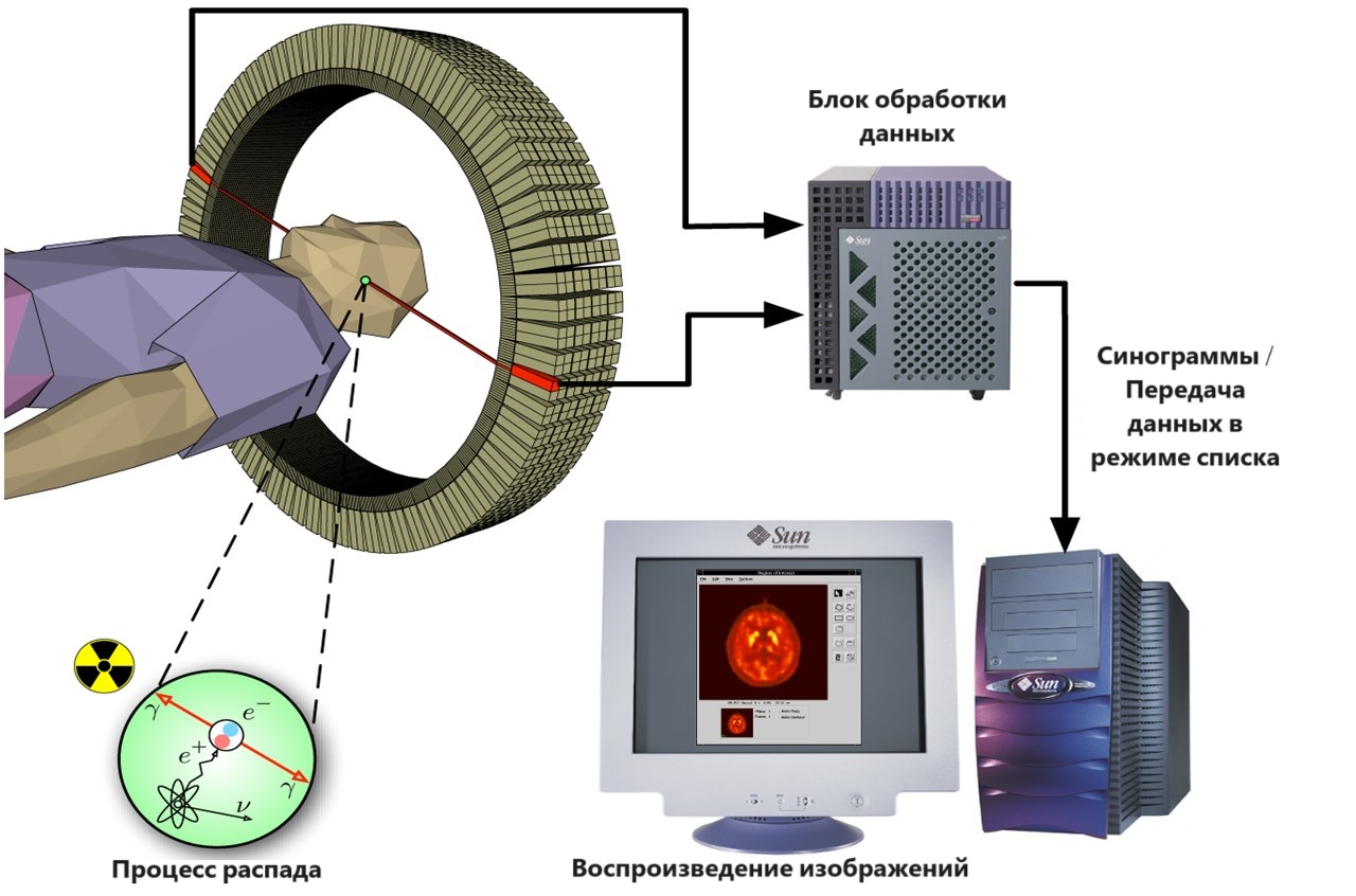 Принцип действия ПЭТ-КТ