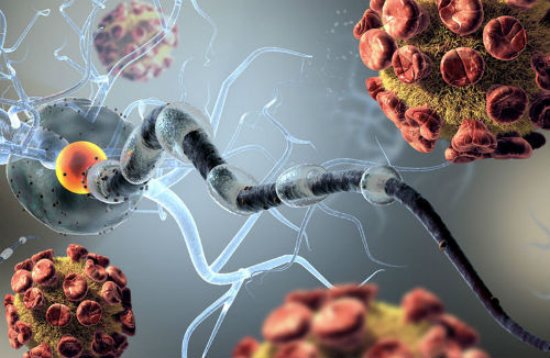 Рассеянный энцефаломиелит - симптомы и диагностика