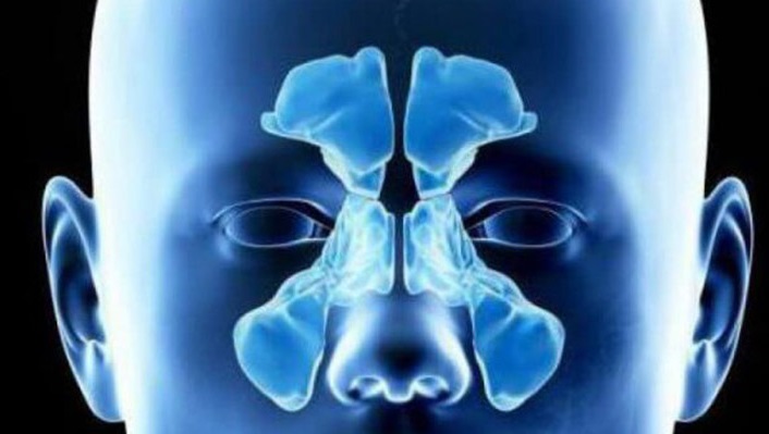 Рентген пазух носа - диагностика