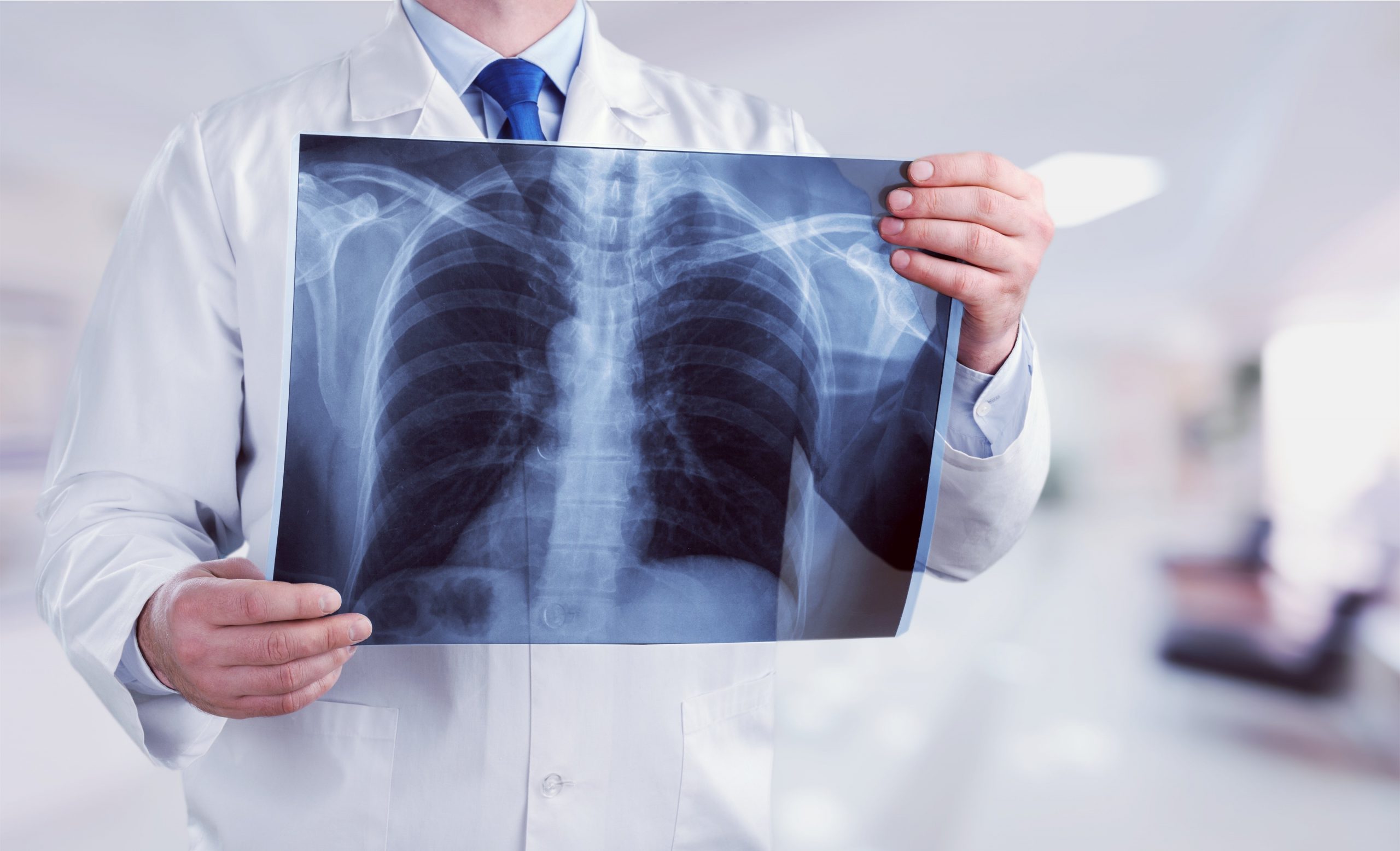 Рентген грудного отдела позвоночника - показания