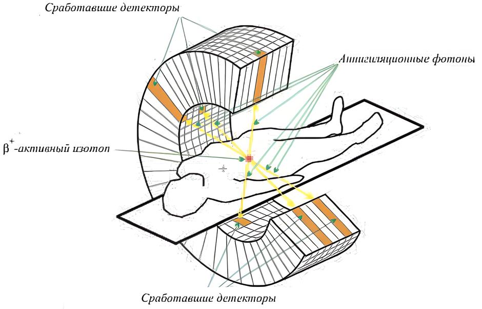 Схема работы ПЭТ-КТ томографа