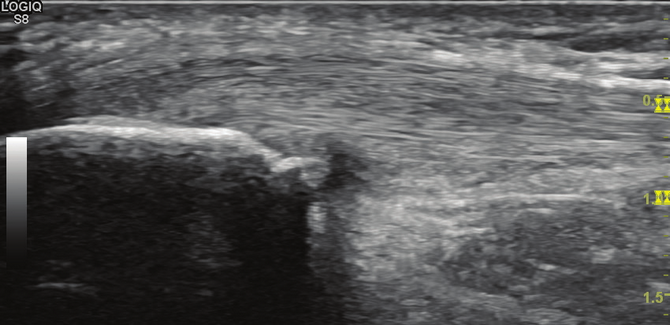 УЗИ голеностопного сустава - что показывают снимки