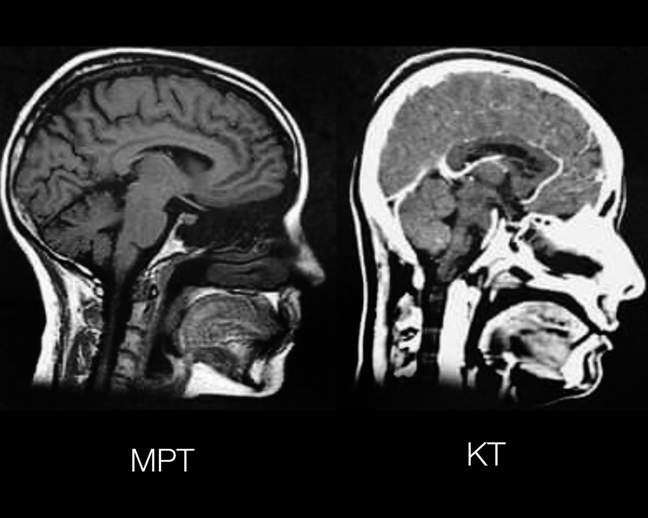 Отличия снимков головы на МРТ и КТ